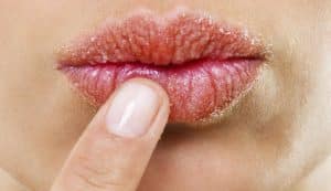 hidratar tus labios